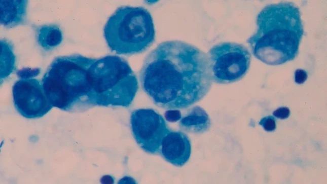 virus-hiv.jpg