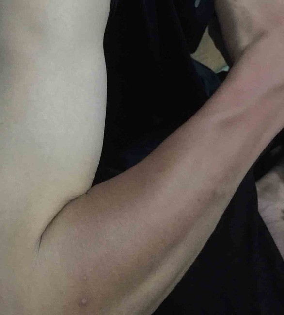 Nắng rát 38 độ C, đề phòng tia cực tím gây ung thư da - Ảnh 2. Nắng rát 38 độ C, đề phòng tia cực tím gây ung thư da - Ảnh 2.