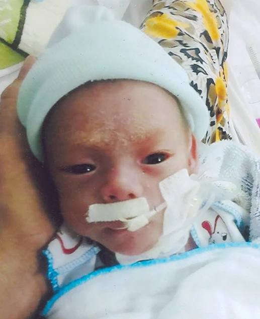 Bé Huỳnh Nhật Huy lúc mới sinh