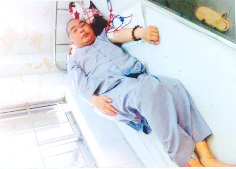 Giúp Sa-di Nguyên Minh điều trị bệnh