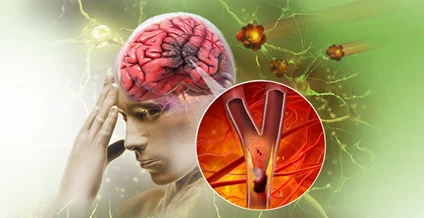 Soda - là thức uống gây tác hại tới sức khỏe cần hạn chế, trong đó có việc gây đột quỵ