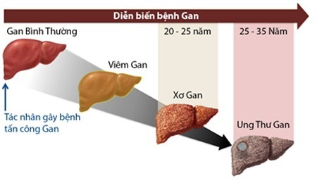 Do đâu gan bị phá hủy?