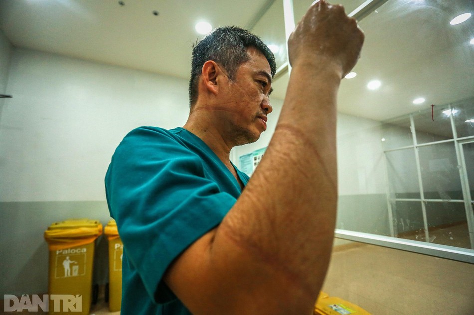 Những vết hằn cắt trên mặt, trên tay của bác sĩ Linh lộ ra khi cởi bỏ lớp đồ bảo hộ sau nhiều giờ làm việc liên tục. Những vết hằn cắt trên mặt, trên tay của bác sĩ Linh lộ ra khi cởi bỏ lớp đồ bảo hộ sau nhiều giờ làm việc liên tục.