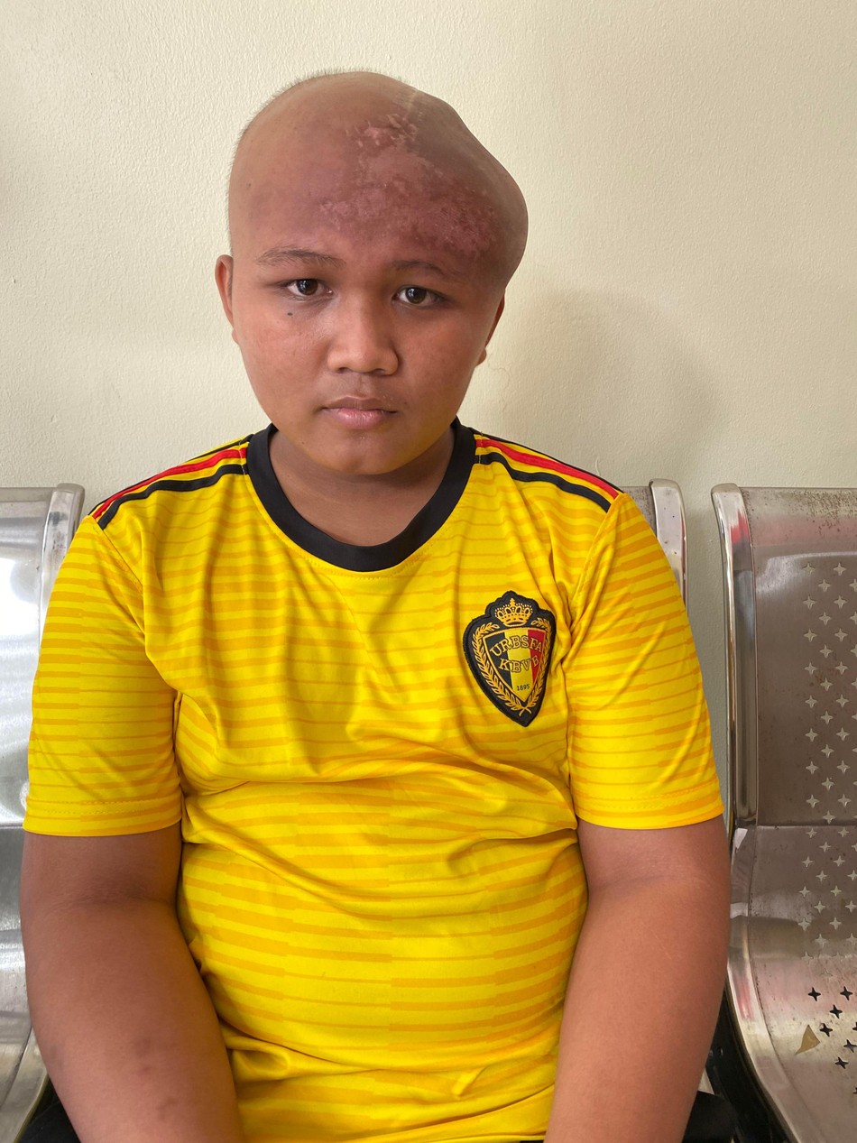 Em Hiếu Hùng bị ung thư não Em Hiếu Hùng bị ung thư não