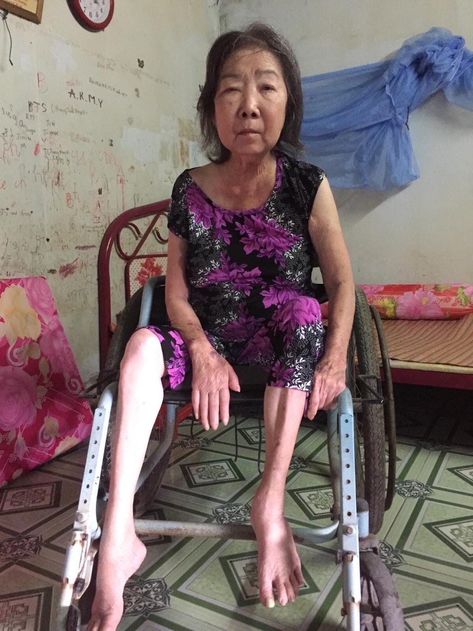 Bà Bòn bị bệnh tai biến khiến liệt nửa người bên phải