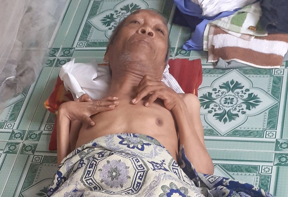 Ông Nguyễn Tấn Hoàng với đôi tay co quắp Ông Nguyễn Tấn Hoàng với đôi tay co quắp