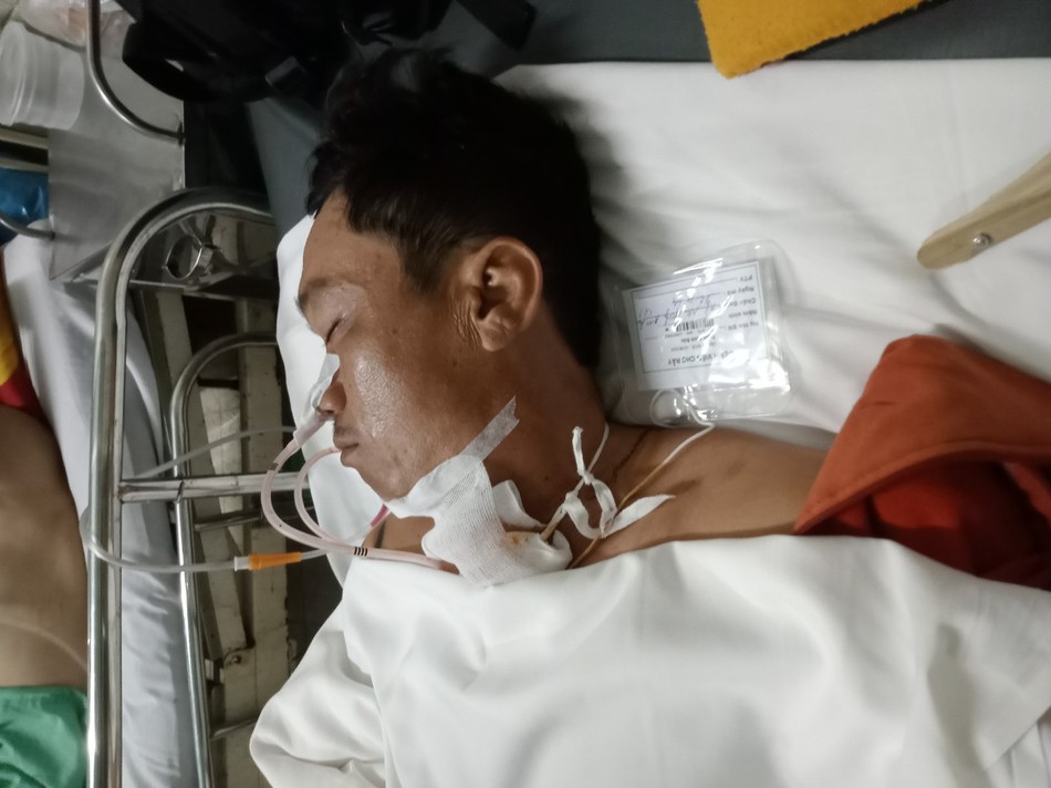 Anh Minh Đức hẹp khí quản Anh Minh Đức hẹp khí quản