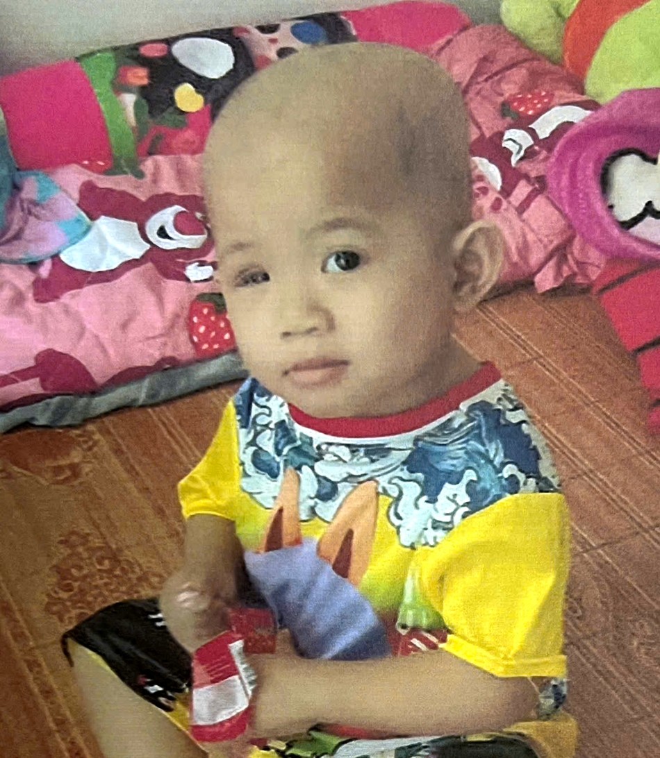 cháu Nguyễn Ngọc Gia Linh bị ung thư nguyên bào võng mạc