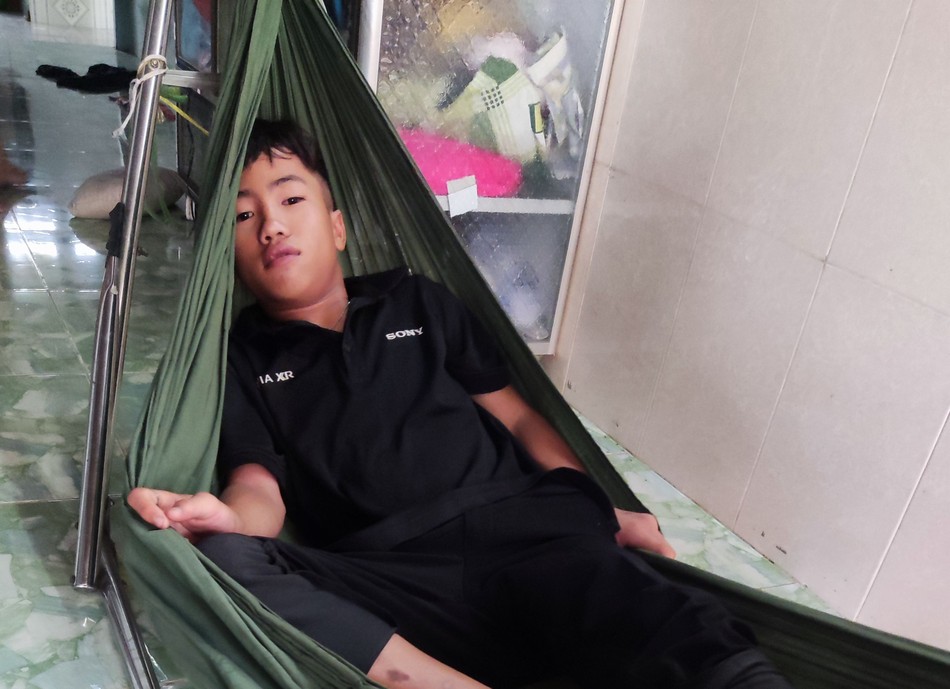 Cháu Duy mắc bệnh động kinh, di chứng chấn thương sọ não, liệt vận nhãn trong bên phải