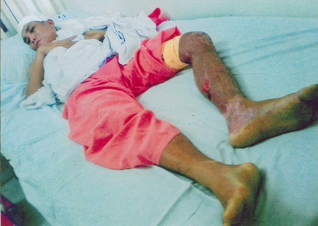 Một hoàn cảnh cần giúp đỡ ảnh 1 mo rong long tu.jpg