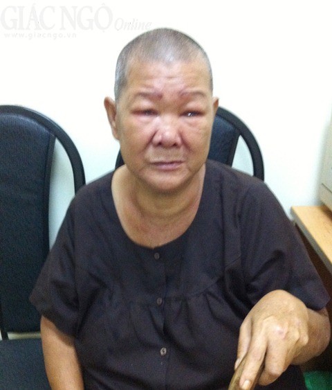 Hai mẹ con nghèo bệnh nặng ảnh 1 MRLT.jpg