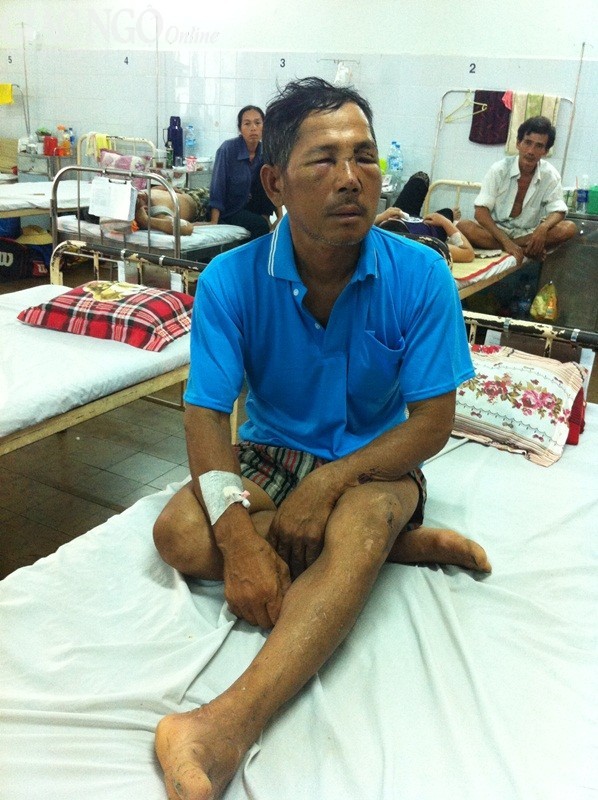 Nằm viện, không tiền phẫu thuật ảnh 1 MR.jpg