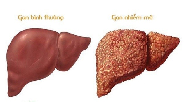 gannhiemmo-1.jpg