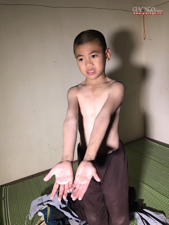 Thực hư vụ việc "bé trai mồ côi bị sư thầy đánh bầm tím" ảnh 3 athanhhoa1.jpg