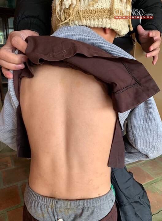 Thực hư vụ việc "bé trai mồ côi bị sư thầy đánh bầm tím" ảnh 1 athanhhoa3.jpg