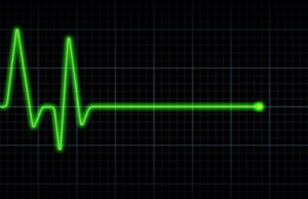 Con người vì sao bị đột tử, phòng ngừa ra sao? ảnh 1 sudden-death-1-1555253081-2922-7474-8589-1559400976_png.png